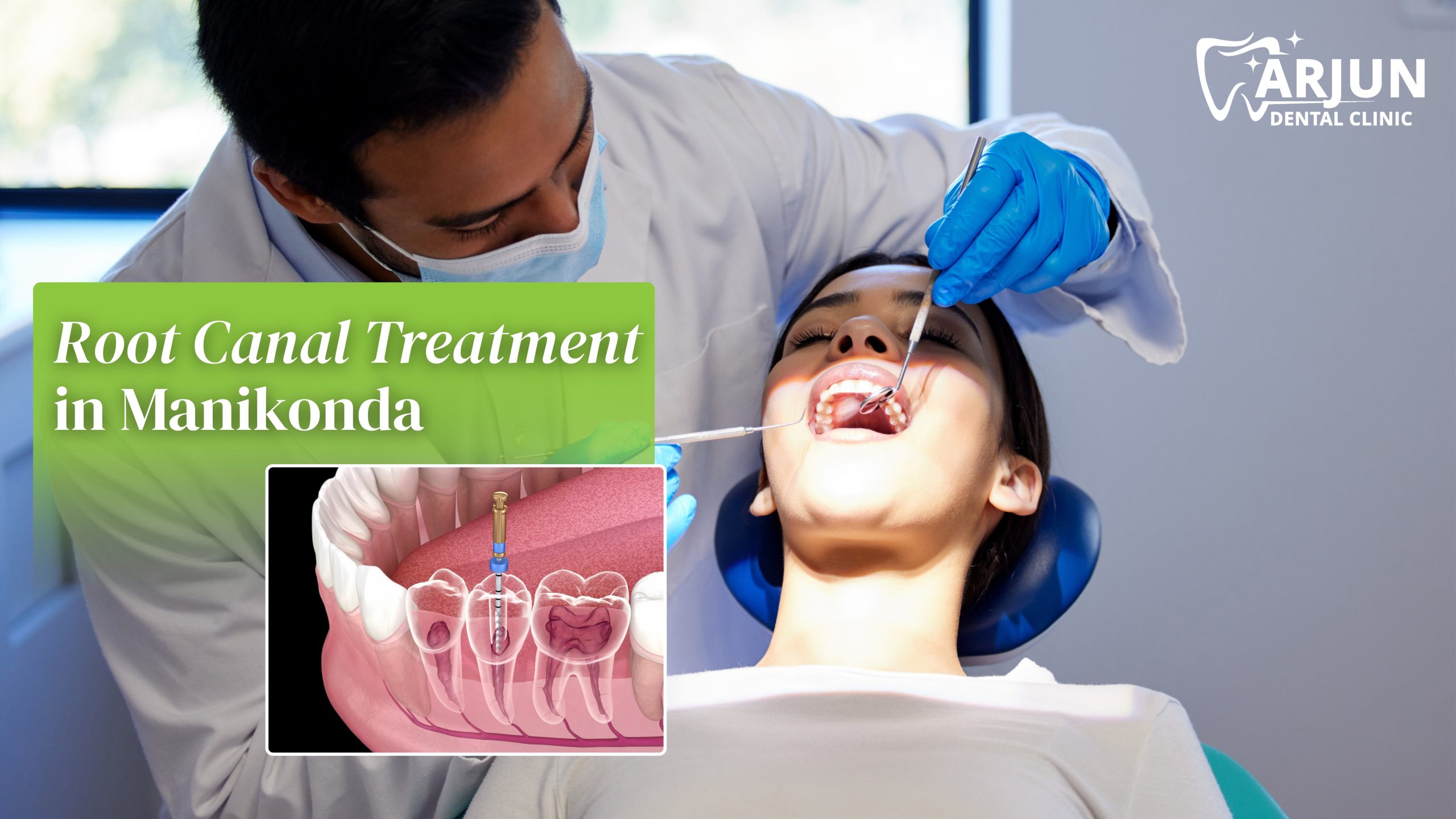 root canal treatment in Manikonda